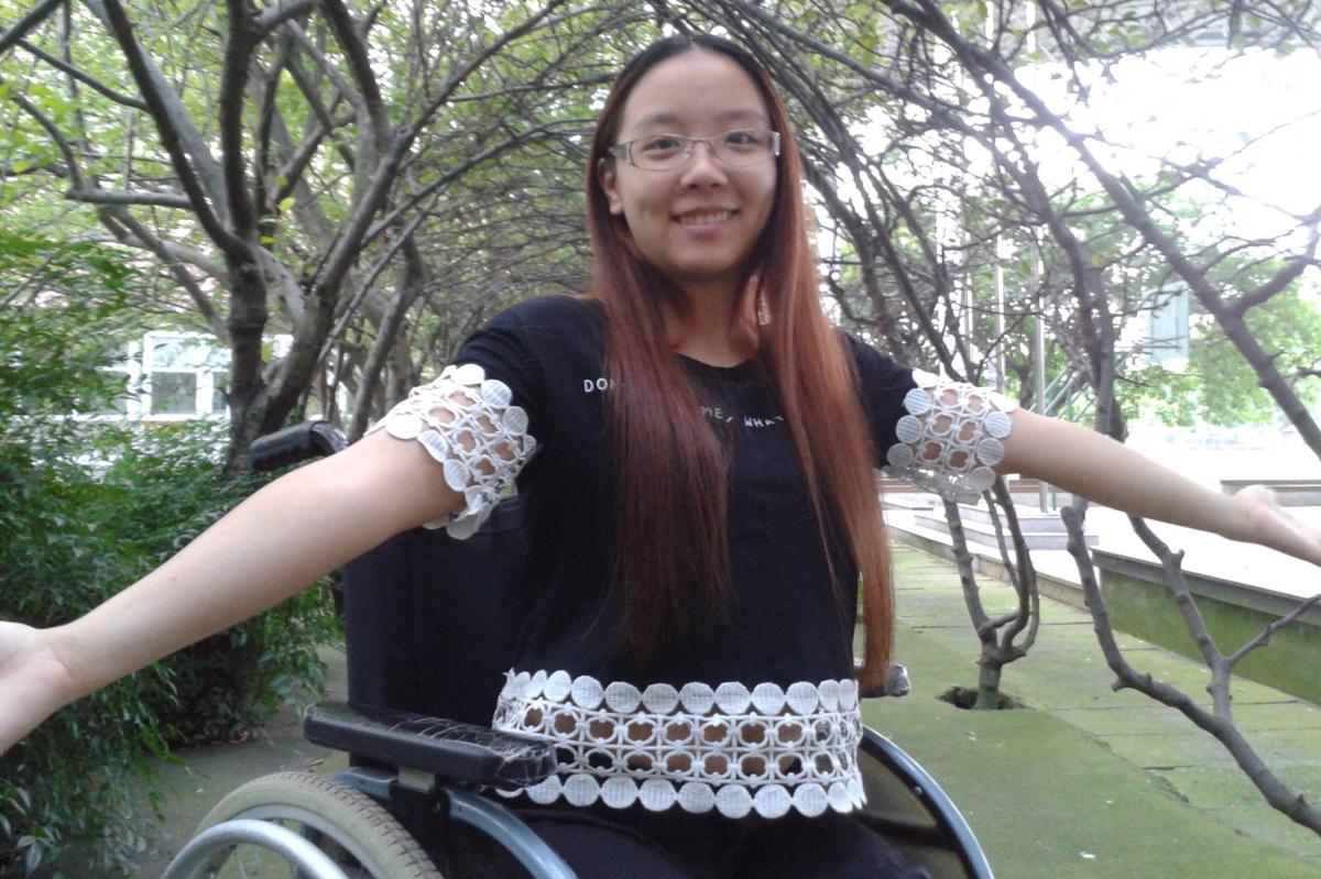 Shattered+Knee Huang Meihua, 18, lost both her legs above the knee in a devastating ...