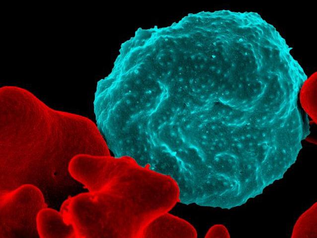 A red blood cell infected with malaria parasites (blue) sits next to normal cells (red). A red blood cell infected with malaria parasites (blue) sits next to normal cells (red).