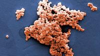 Streptococcus bacteria, like this strain, can be found in our guts. Streptococcus bacteria, like this strain, can be found in our guts.