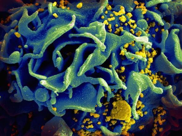 HIV particles, yellow, infect an immune cell, blue. HIV particles, yellow, infect an immune cell, blue.