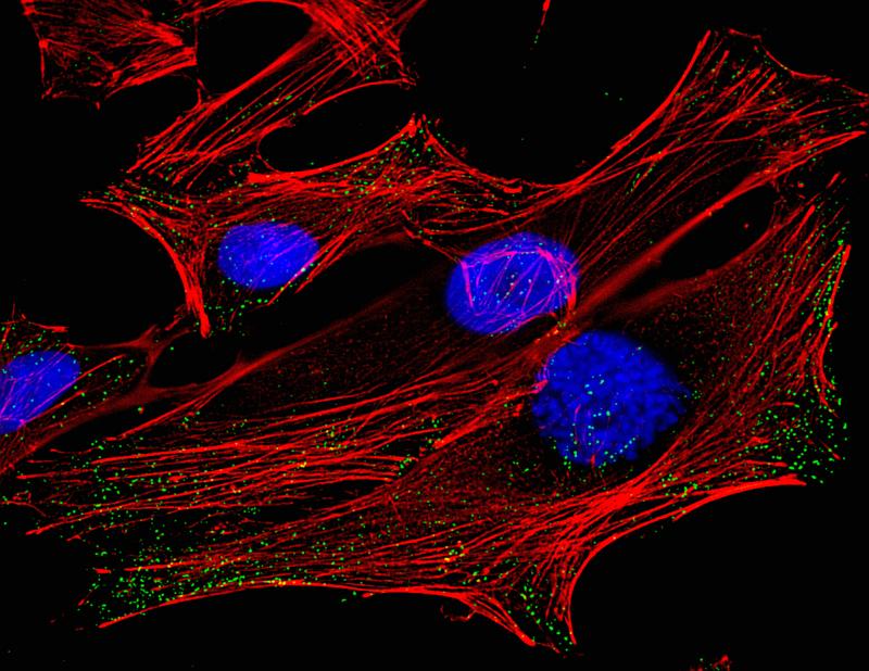 A micrograph of HeLa cells, derived from cervical cancer cells taken from Henrietta Lacks. A micrograph of HeLa cells, derived from cervical cancer cells taken from Henrietta Lacks.