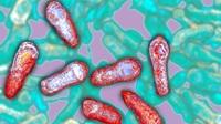 The botulism toxin comes from Clostridium botulinum bacteria, seen here in a colorized micrograph. The botulism toxin comes from Clostridium botulinum bacteria, seen here in a colorized micrograph.