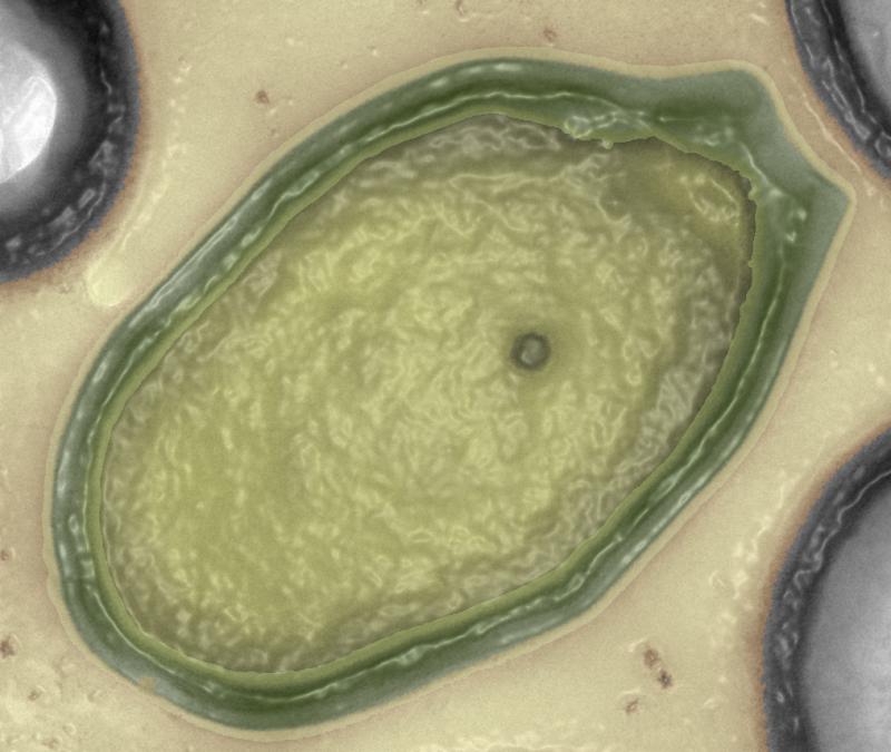 Pandoraviruses were discovered lurking in the mud of Chile and Australia, half a world apart. Pandoraviruses were discovered lurking in the mud of Chile and Australia, half a world apart.