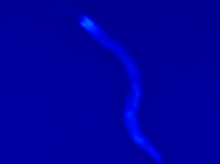 A nematode worm glows as it nears death in this screenshot from a YouTube video showing the work of researchers in London. A nematode worm glows as it nears death in this screenshot from a YouTube video showing the work of researchers in London.