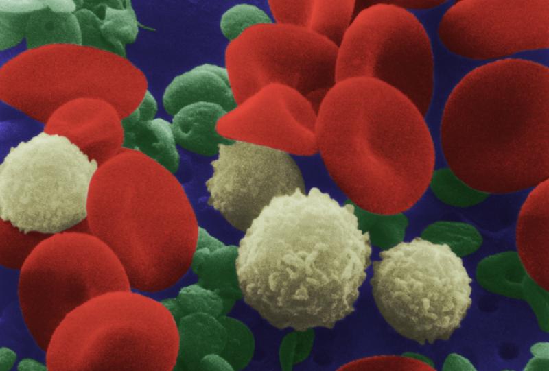 Plump red blood cells — tumbling amid infection-fighting white blood cells and purple platelets in this colorized, microscopic view — need adequate levels of iron to be able to carry and deliver oxygen around the body. Iron-deficiency anemia is someti Plump red blood cells — tumbling amid infection-fighting white blood cells and purple platelets in this colorized, microscopic view — need adequate levels of iron to be able to carry and deliver oxygen around the body. Iron-deficiency anemia is someti