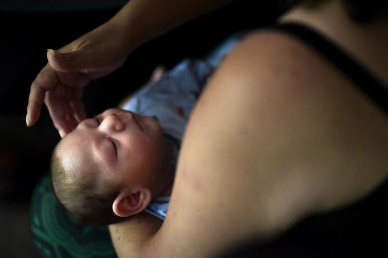 Puerto Rico resident Michelle Flandez caresses her two-month-old son Inti Perez, diagnosed with microcephaly linked to the mosquito-borne Zika virus. The U.S. Centers for Disease Control and Prevention says the Zika virus continues to impact a small numbe Puerto Rico resident Michelle Flandez caresses her two-month-old son Inti Perez, diagnosed with microcephaly linked to the mosquito-borne Zika virus. The U.S. Centers for Disease Control and Prevention says the Zika virus continues to impact a small numbe