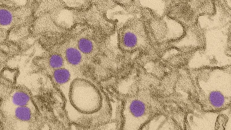 Zika virus particles (colored purple in this scan) infecting cells. Each particle is about 40 nanometers in diameter. Zika virus particles (colored purple in this scan) infecting cells. Each particle is about 40 nanometers in diameter.