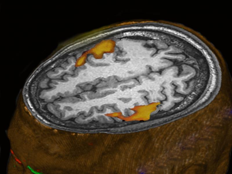 An MRI scan of a person listening to music shows brain areas that respond. (This scan wasn't part of the research comparing humans and monkeys.) An MRI scan of a person listening to music shows brain areas that respond. (This scan wasn't part of the research comparing humans and monkeys.)