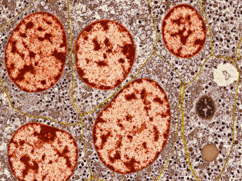 Patients with Type-1 diabetes don't have enough healthy islets of Langerhans cells — hormone-secreting cells of the pancreas. Granules (orange in this image) inside these cells release insulin and other substances into the blood. Patients with Type-1 diabetes don't have enough healthy islets of Langerhans cells — hormone-secreting cells of the pancreas. Granules (orange in this image) inside these cells release insulin and other substances into the blood.