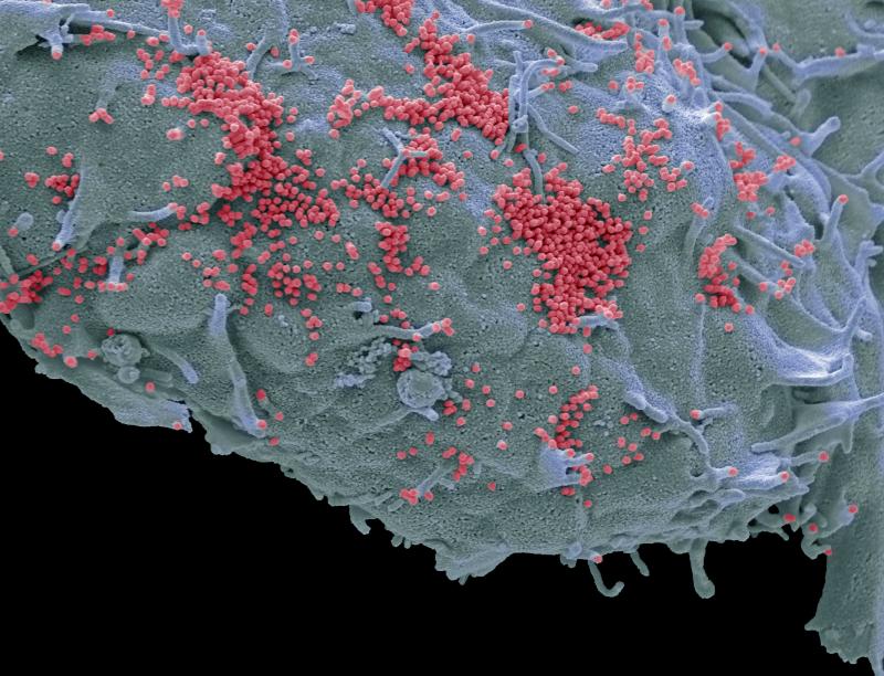 This colorized scanning electron micrograph shows human cells in a lab infected with "pink" influenza viruses. As many as 650,000 people each year die from flu, according to the World Health Organization. This colorized scanning electron micrograph shows human cells in a lab infected with "pink" influenza viruses. As many as 650,000 people each year die from flu, according to the World Health Organization.