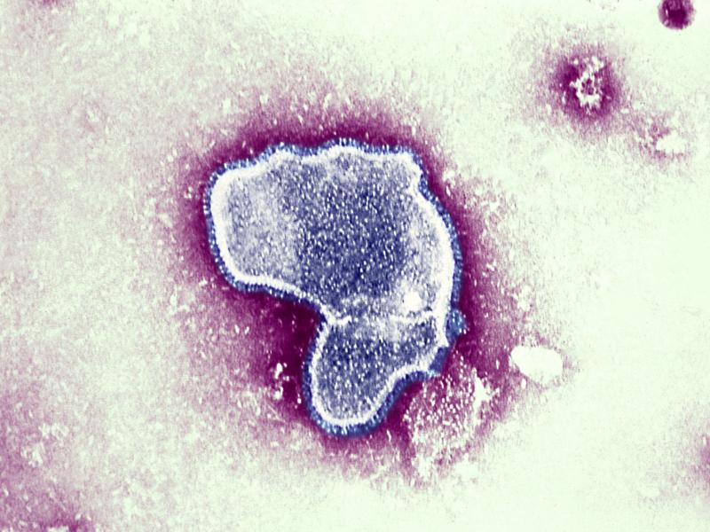 At the moment there is little data available on the impact of contracting COVID-19 and the respiratory syncytial virus (pictured), and whether together they can make a person sicker. But health officials worry it could put young patients — who are not e At the moment there is little data available on the impact of contracting COVID-19 and the respiratory syncytial virus (pictured), and whether together they can make a person sicker. But health officials worry it could put young patients — who are not e