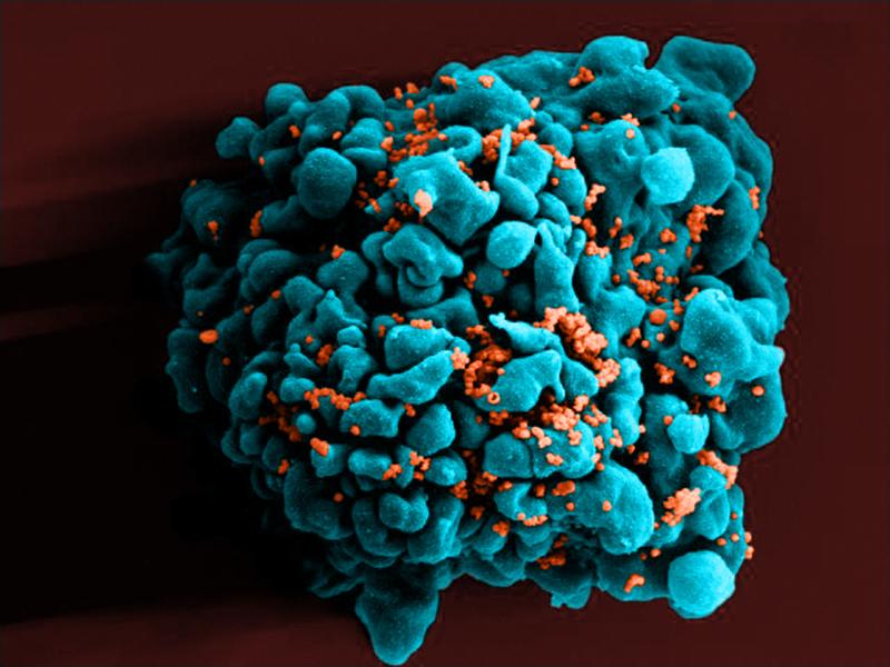 A color-enhanced scanning electron micrograph shows HIV particles (orange) infecting a T cell, one of the white blood cells that play a central role in the immune system. A color-enhanced scanning electron micrograph shows HIV particles (orange) infecting a T cell, one of the white blood cells that play a central role in the immune system.