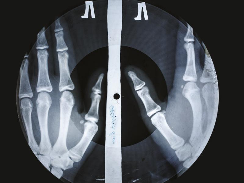 X-Ray Audio: The Strange Story of Soviet Music on the Bone explores a curious bootlegging practice that arose in Cold War Russia. X-Ray Audio: The Strange Story of Soviet Music on the Bone explores a curious bootlegging practice that arose in Cold War Russia.