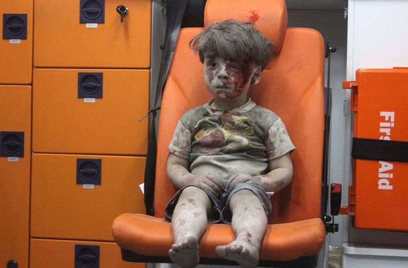 5-year-old wounded Syrian child Omran Daqneesh sits alone in the back of the ambulance after he was injured during air strikes targeting Aleppo on Wednesday. 5-year-old wounded Syrian child Omran Daqneesh sits alone in the back of the ambulance after he was injured during air strikes targeting Aleppo on Wednesday.