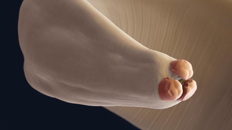 The giant roundworm, Ascaris lumbricoides, shows its three serrated lips. The giant roundworm, Ascaris lumbricoides, shows its three serrated lips.