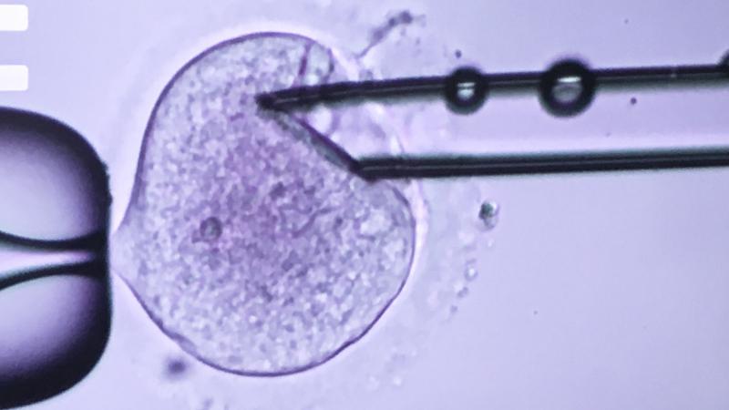A scientist from the Nadiya Clinic in Kiev, Ukraine inserts a needle into a fertilized egg to extract the DNA of a man and woman trying to have a baby. The clinic is combining the DNA from three different people to create babies for women who are infertil A scientist from the Nadiya Clinic in Kiev, Ukraine inserts a needle into a fertilized egg to extract the DNA of a man and woman trying to have a baby. The clinic is combining the DNA from three different people to create babies for women who are infertil