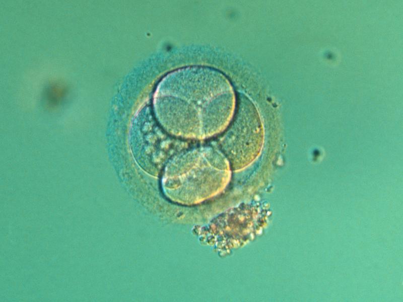New guidance would ease restrictions on researching embryos in the lab. New guidance would ease restrictions on researching embryos in the lab.