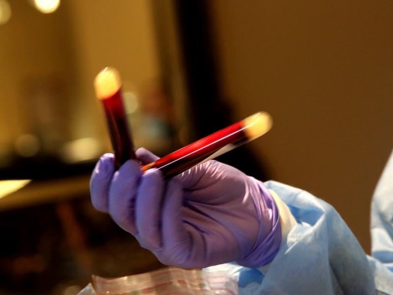 A new study that analyzed blood donations from December 2019 to early January helped show that the coronavirus infected people in the U.S. earlier than previously thought. A new study that analyzed blood donations from December 2019 to early January helped show that the coronavirus infected people in the U.S. earlier than previously thought.