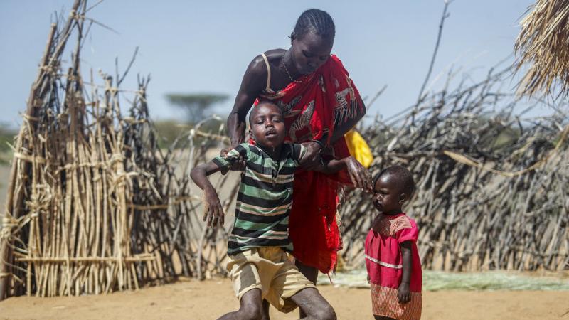 A mother helps her malnourished son stand after he collapsed near their hut in the village of Lomoputh in northern Kenya on Thursday. A severe drought and spiking food prices are causing a humanitarian emergency in the Horn of Africa. A mother helps her malnourished son stand after he collapsed near their hut in the village of Lomoputh in northern Kenya on Thursday. A severe drought and spiking food prices are causing a humanitarian emergency in the Horn of Africa.