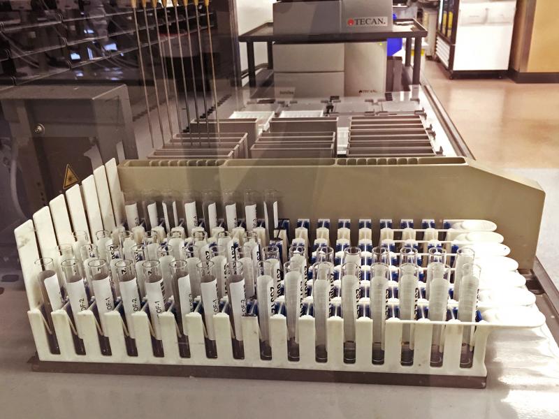 The drug test developed by Aegis Sciences checks urine samples to help doctors determine if their patients are taking their blood pressure medicine. The drug test developed by Aegis Sciences checks urine samples to help doctors determine if their patients are taking their blood pressure medicine.