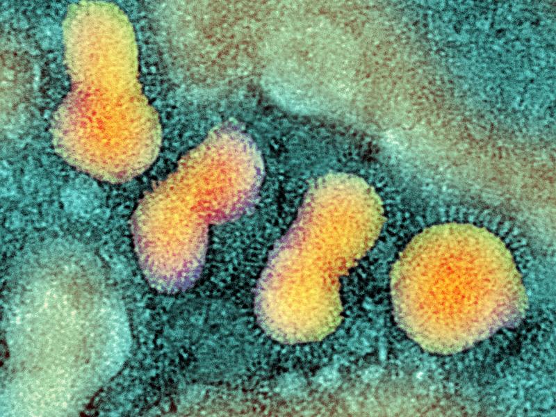 Experiments that showed how to make the H5N1 bird flu virus more contagious raised concern about malicious misuse of laboratory research. Experiments that showed how to make the H5N1 bird flu virus more contagious raised concern about malicious misuse of laboratory research.