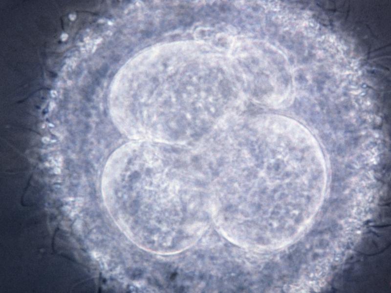 A light micrograph of a primitive human embryo, composed of four cells, following the initial mitotic divisions that ultimately transform a single-cell organism into one composed of millions of cells. A light micrograph of a primitive human embryo, composed of four cells, following the initial mitotic divisions that ultimately transform a single-cell organism into one composed of millions of cells.
