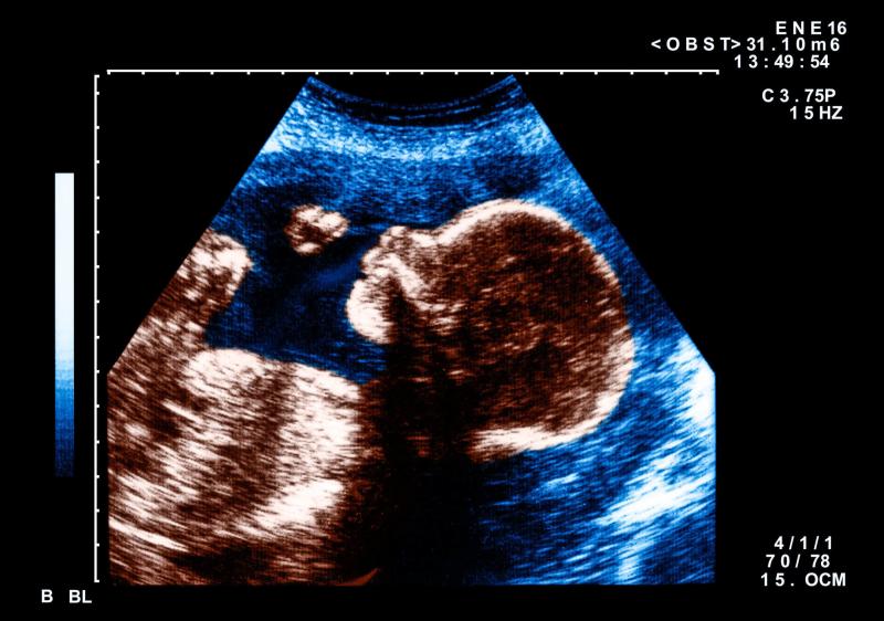 Fetuses in the third trimester responded more often to patterns that resembled faces than to patterns that did not. Fetuses in the third trimester responded more often to patterns that resembled faces than to patterns that did not.