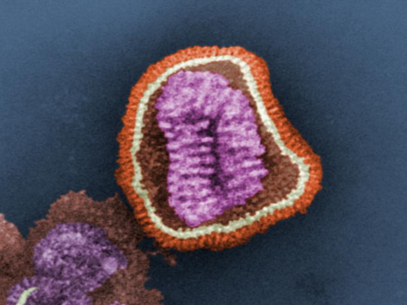 This negative-stained transmission electron micrograph depicts the ultrastructural details of an influenza virus particle, or virion. This negative-stained transmission electron micrograph depicts the ultrastructural details of an influenza virus particle, or virion.