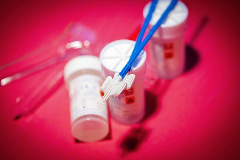 Testing for changes in cells of the cervix or for presence of the HPV virus are both good ways to screen for cervical cancer, health organizations say. Testing for changes in cells of the cervix or for presence of the HPV virus are both good ways to screen for cervical cancer, health organizations say.