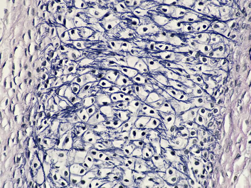 Human fetal tissue (stock photo) Human fetal tissue (stock photo)