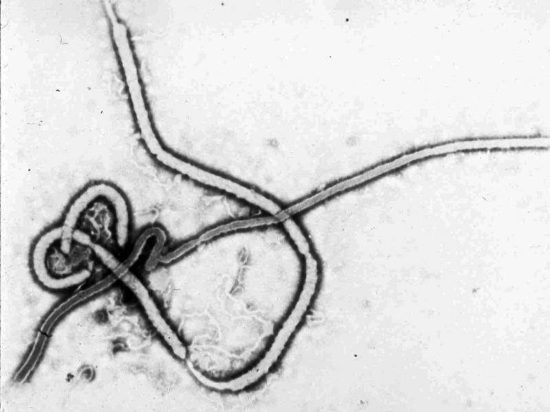An electron micrograph photo of the Ebola virus, provided by the Centers for Disease Control and Prevention in Atlanta. An electron micrograph photo of the Ebola virus, provided by the Centers for Disease Control and Prevention in Atlanta.