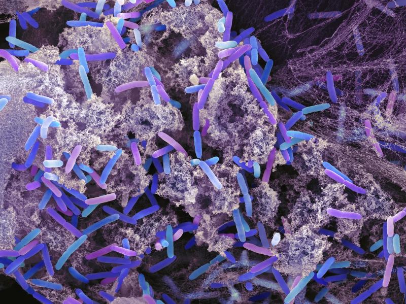 Pseudomonas aeruginosa bacteria — rod-shaped bacteria in this tinted, scanning electron microscope image — are found in soil, water and as normal flora in the human intestine. But they can cause serious wound, lung, skin and urinary tract infections, Pseudomonas aeruginosa bacteria — rod-shaped bacteria in this tinted, scanning electron microscope image — are found in soil, water and as normal flora in the human intestine. But they can cause serious wound, lung, skin and urinary tract infections,