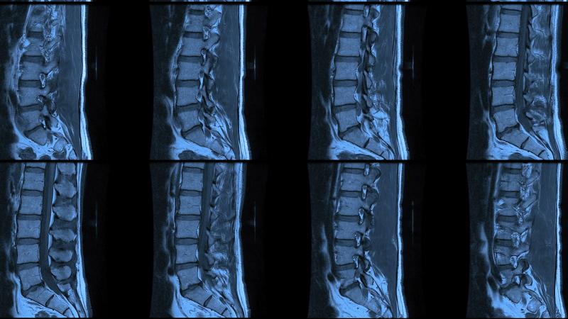 In 49 U.S. states, spotting the squished disc in this spinal MRI is still much easier than learning the price of the MRI in advance. In 49 U.S. states, spotting the squished disc in this spinal MRI is still much easier than learning the price of the MRI in advance.
