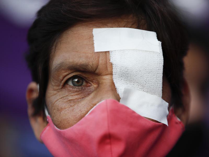 A woman has one eye covered to protest against gender violence, in Buenos Aires, Argentina, Wednesday, Feb. 17, 2021. Women from the "Ni Una Menos" or "Not One Less" movement marched to protest what they say is the negligence of judges when it comes to ta A woman has one eye covered to protest against gender violence, in Buenos Aires, Argentina, Wednesday, Feb. 17, 2021. Women from the "Ni Una Menos" or "Not One Less" movement marched to protest what they say is the negligence of judges when it comes to ta