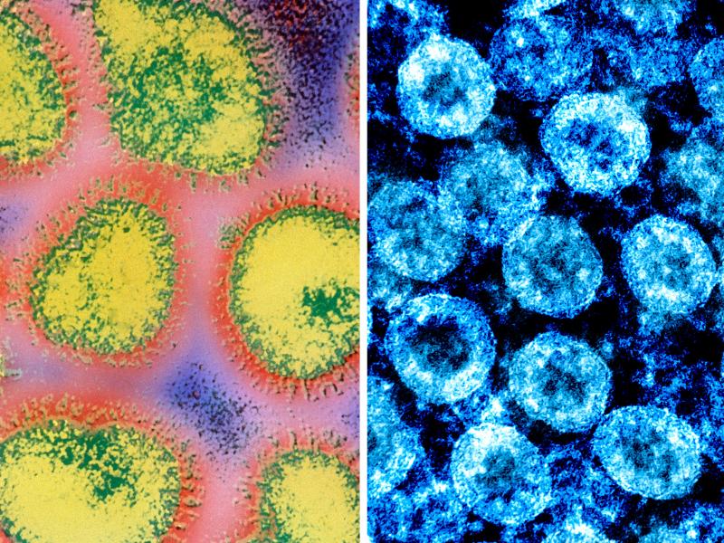 At left: a colorized electron micrograph image of the influenza virus. At right: color-enhanced electron micrograph image of SARS-CoV-2 virus particles, isolated from a patient. At left: a colorized electron micrograph image of the influenza virus. At right: color-enhanced electron micrograph image of SARS-CoV-2 virus particles, isolated from a patient.