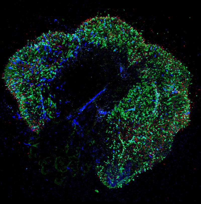 A 291-day-old retina. Our ability to see colors develops in the womb. Now scientists have replicated that process, which could help accelerate efforts to cure colorblindness and lead to new treatments for diseases. A 291-day-old retina. Our ability to see colors develops in the womb. Now scientists have replicated that process, which could help accelerate efforts to cure colorblindness and lead to new treatments for diseases.