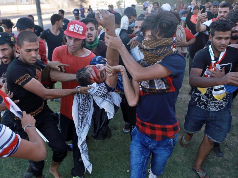 An injured protester is rushed to the hospital after being shot during a demonstration in early October in Baghdad, Iraq. An injured protester is rushed to the hospital after being shot during a demonstration in early October in Baghdad, Iraq.