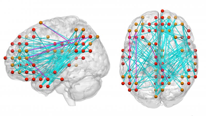 Maps of connections in the brain are helping researchers better understand attention deficit hyperactivity disorder. Maps of connections in the brain are helping researchers better understand attention deficit hyperactivity disorder.