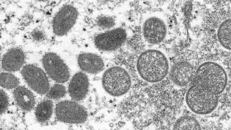 This 2003 electron microscope image made available by the Centers for Disease Control and Prevention shows mature, oval-shaped monkeypox virus particles, left, and spherical immature particles, right. This 2003 electron microscope image made available by the Centers for Disease Control and Prevention shows mature, oval-shaped monkeypox virus particles, left, and spherical immature particles, right.