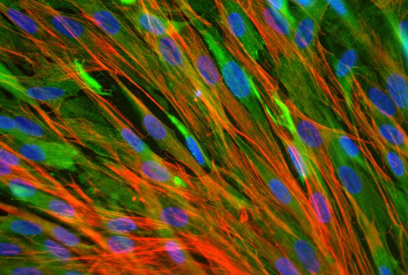 Skeletal muscle cells from a rabbit were stained with fluorescent markers to highlight cell nuclei (blue) and proteins in the cytoskeleton (red and green). Skeletal muscle cells from a rabbit were stained with fluorescent markers to highlight cell nuclei (blue) and proteins in the cytoskeleton (red and green).