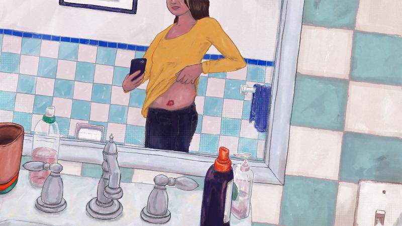 Wounds infected with antibiotic-resistant staph often heal, but the bacteria can remain inside a person's body and cause future infections. Wounds infected with antibiotic-resistant staph often heal, but the bacteria can remain inside a person's body and cause future infections.