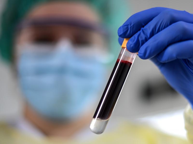 Scientists have studied the blood of people who were part of a large trial for the Moderna vaccine to measures antibodies that can help predict levels of immunity after getting a COVID-19 shot. Scientists have studied the blood of people who were part of a large trial for the Moderna vaccine to measures antibodies that can help predict levels of immunity after getting a COVID-19 shot.