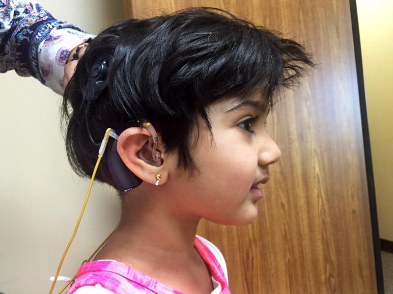 Jiya Bavishi's auditory brainstem implant is helping her hear some sounds for the first time. Jiya Bavishi's auditory brainstem implant is helping her hear some sounds for the first time.