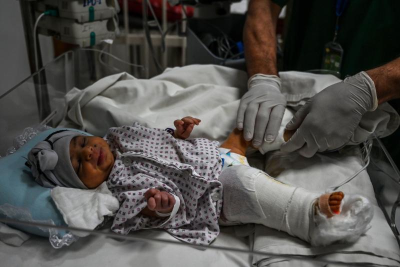 A newborn baby girl receives treatment for the gun wound in her right leg received during the attack on a maternity clinic in Kabul this week. The gunmen killed her mother. A newborn baby girl receives treatment for the gun wound in her right leg received during the attack on a maternity clinic in Kabul this week. The gunmen killed her mother.