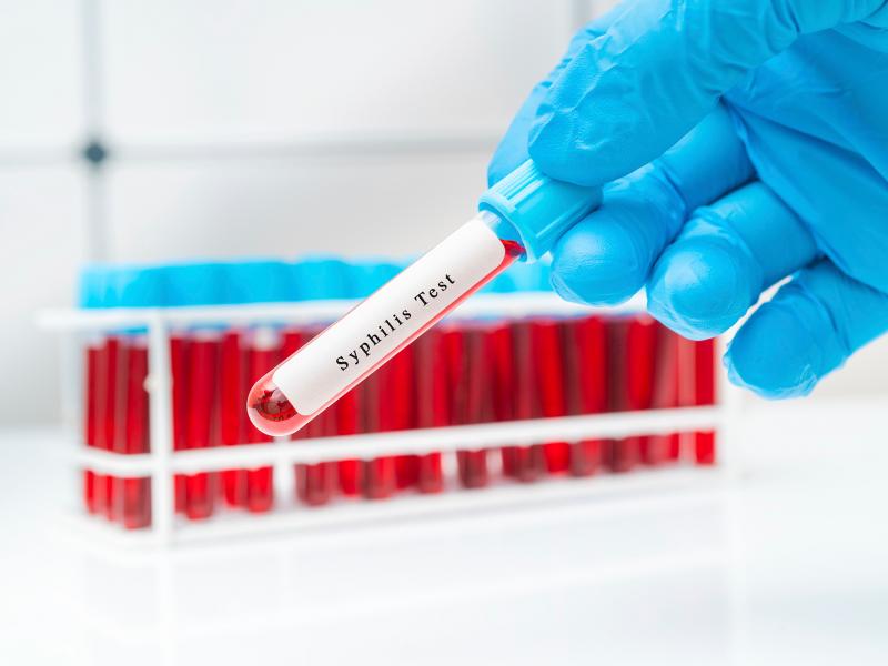 Syphilis cases in California have contributed to soaring national caseloads of sexually transmitted diseases. Experts point to the advent of dating apps, less condom use and an increase in meth. Syphilis cases in California have contributed to soaring national caseloads of sexually transmitted diseases. Experts point to the advent of dating apps, less condom use and an increase in meth.