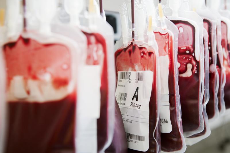 Postpartum hemorrhage is the leading cause of maternal deaths around the world. Postpartum hemorrhage is the leading cause of maternal deaths around the world.