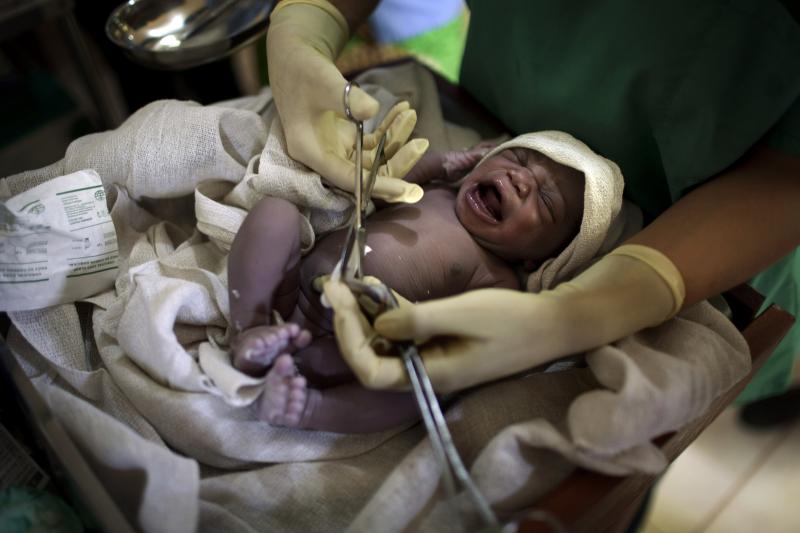 A midwife cuts the umbilical cord of a newborn baby in a hospital in South Sudan. A midwife cuts the umbilical cord of a newborn baby in a hospital in South Sudan.