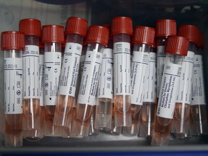 Specimens collected from multiple people can be combined into one batch to test for the coronavirus. A negative result would clear all the specimens. Specimens collected from multiple people can be combined into one batch to test for the coronavirus. A negative result would clear all the specimens.