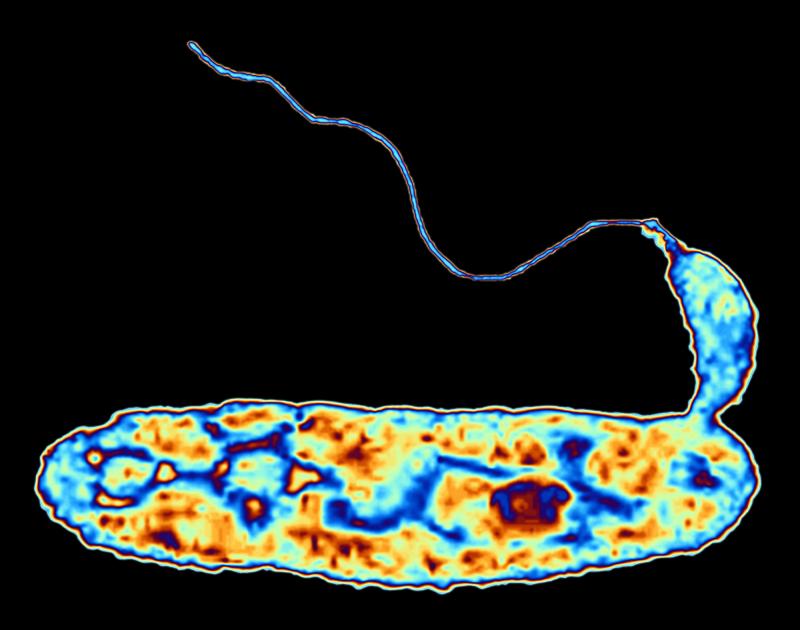 It's a bacteria-eat-bacteria world, scientists say. Bdellovibrio bacteriovorus, shown here in false color, attacks common germs six times its size, then devours them from the inside out. It's a bacteria-eat-bacteria world, scientists say. Bdellovibrio bacteriovorus, shown here in false color, attacks common germs six times its size, then devours them from the inside out.