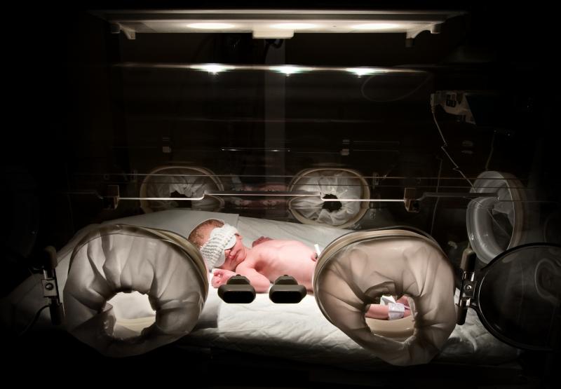 Stress, poverty and lack of health care can lead to premature birth. Rates remain stubbornly high in many states. Stress, poverty and lack of health care can lead to premature birth. Rates remain stubbornly high in many states.